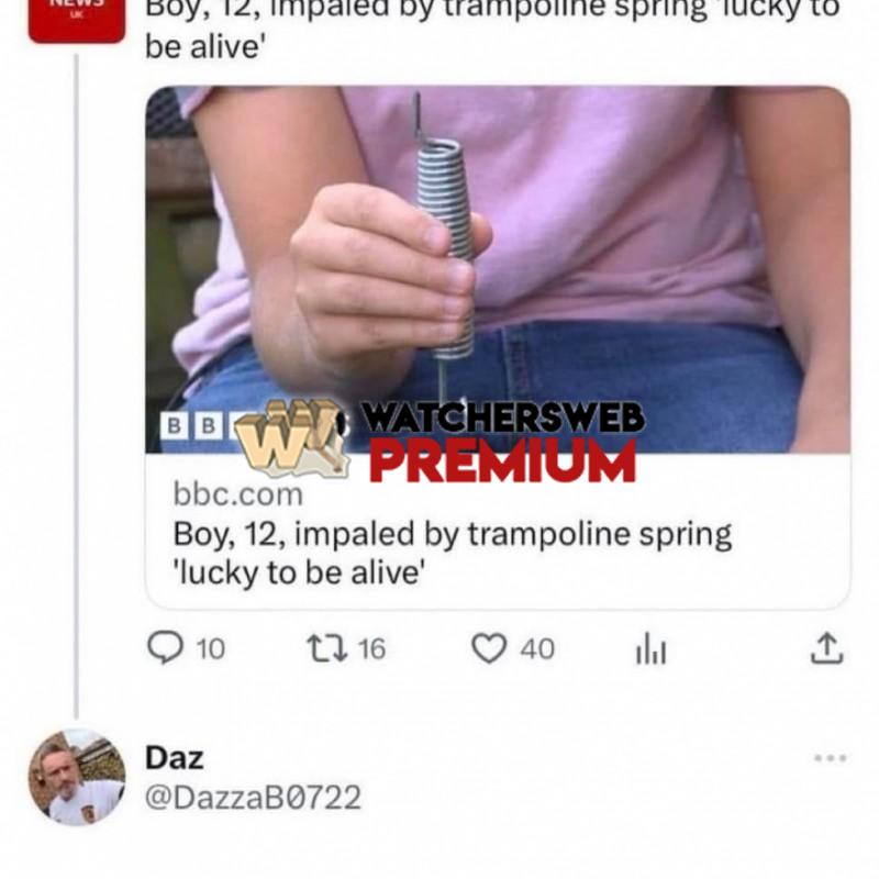 Poor Kid - Ray - QLD, Australia