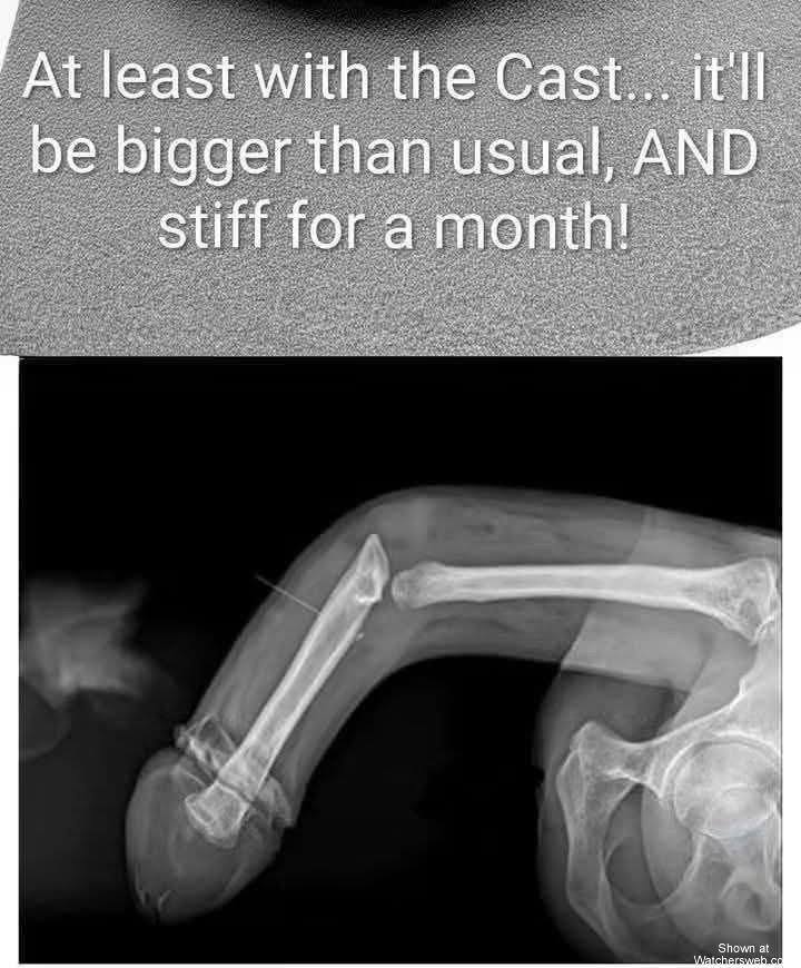 Ouch #0